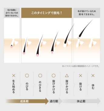 メンズTBC 毛周期の図解