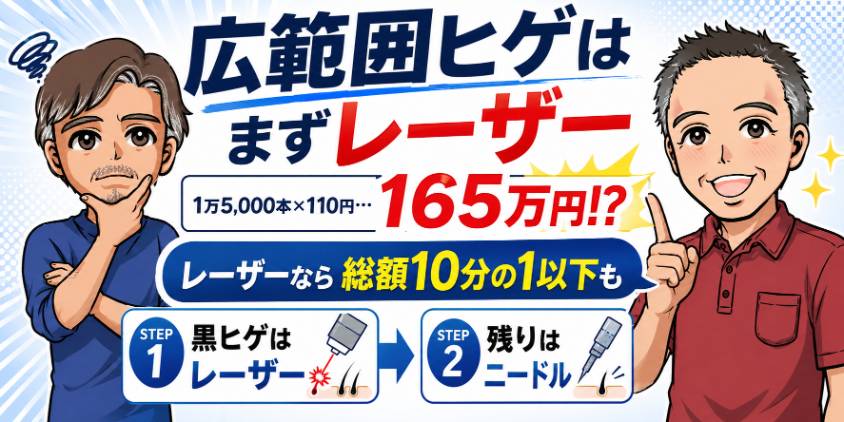 広範囲の黒ヒゲはレーザー脱毛