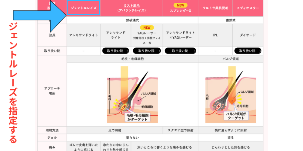 湘南美容外科の脱毛機器の表