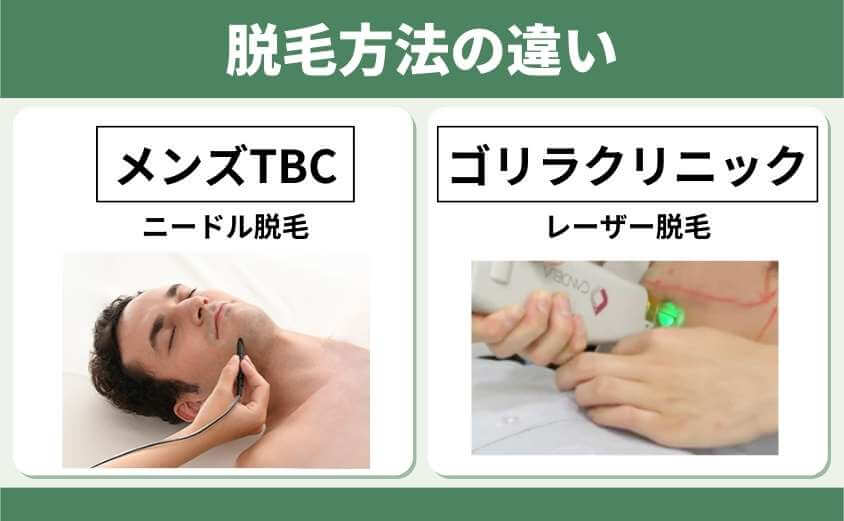 メンズTBCとゴリラクリニックの脱毛方法