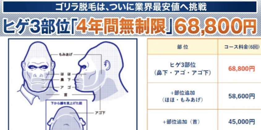 4年間無制限コース・料金表