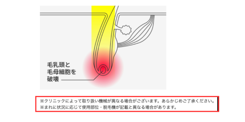 【公式サイト】メンズリゼの脱毛器