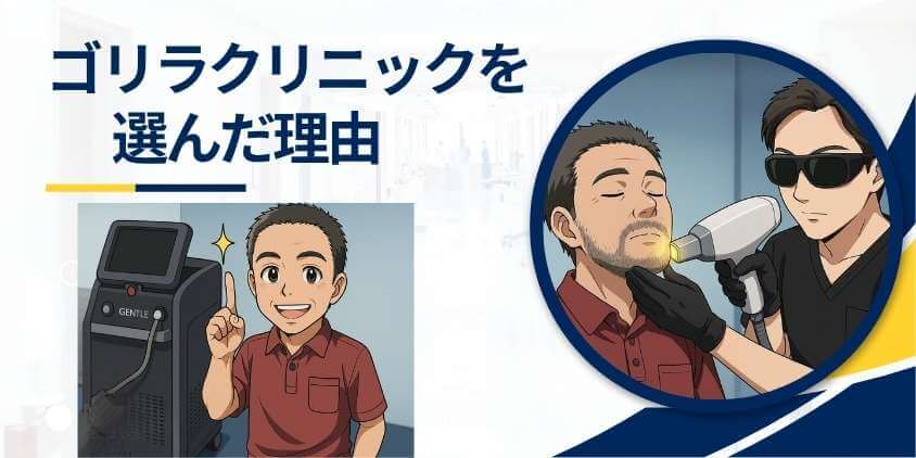 高いと感じたけどゴリラを選んだ理由