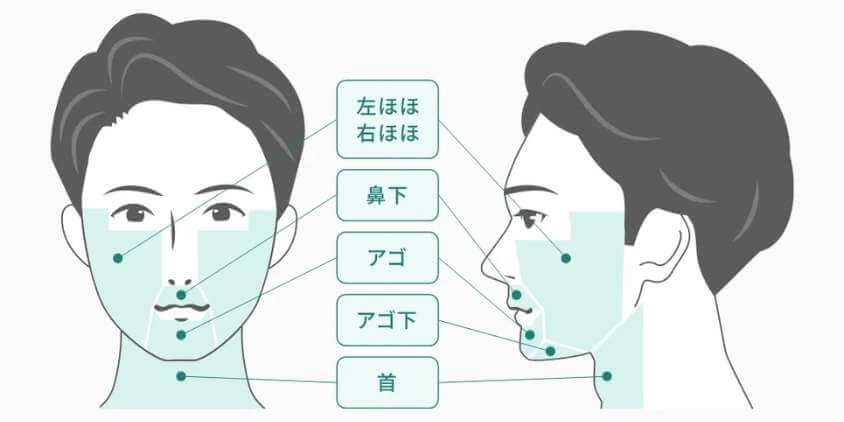 フレイア5部位
