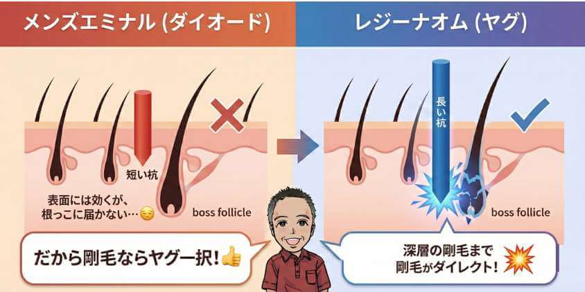 【図解】ヤグとダイオードの特徴