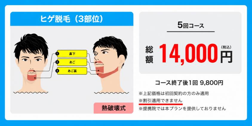 メンズリゼ3部位料金
